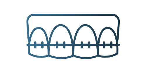 Orthodontic Braces Illustration